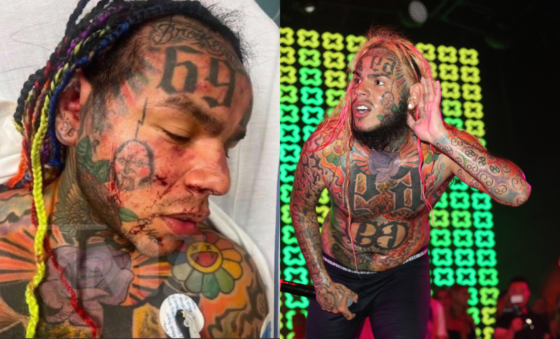 6ix9ine agressé et dépouillé dans une salle de sport de LA